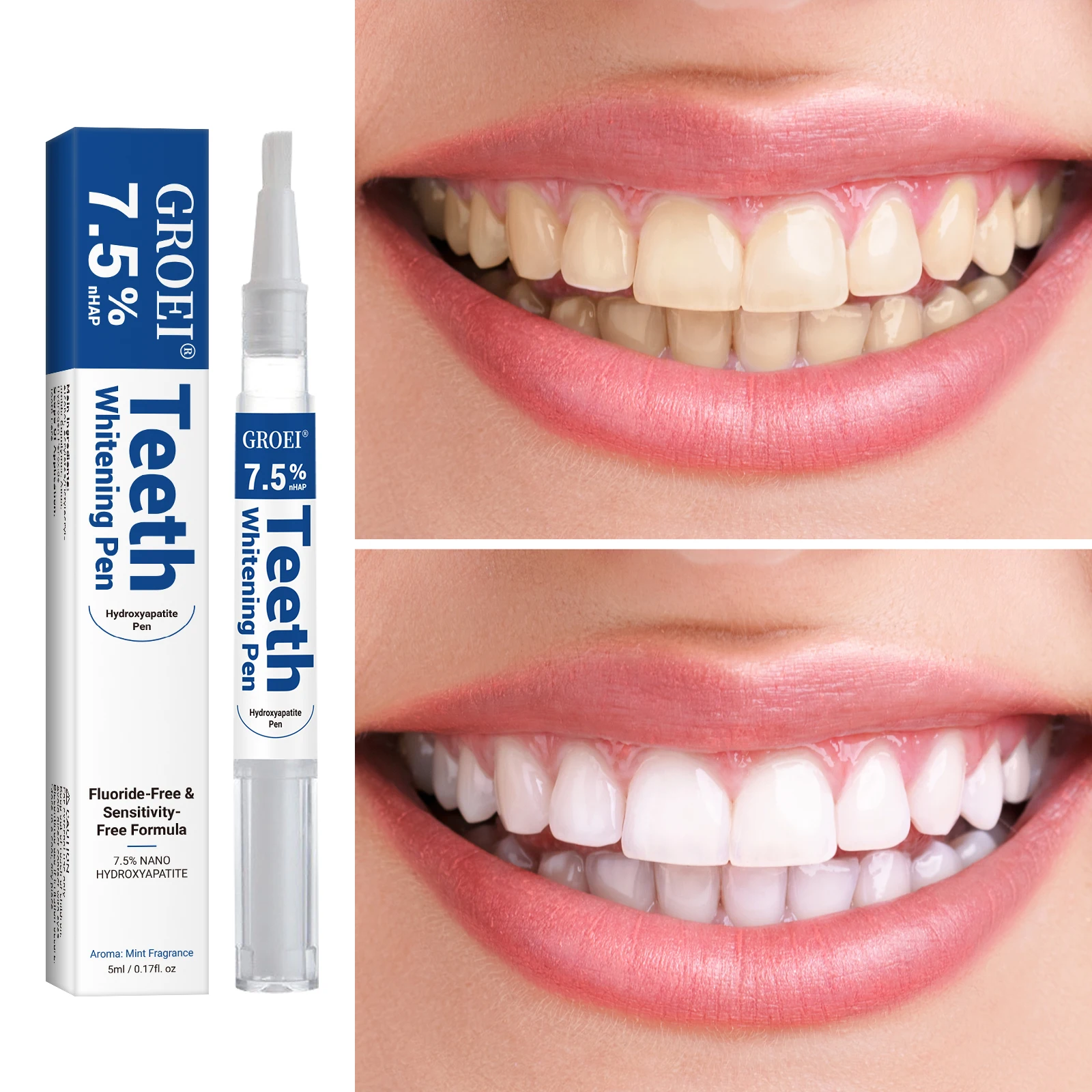 Hydroxyapatite Tooth Whitening - Teeth Whitening Near Me ulasan dan harga