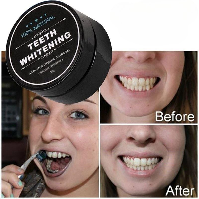 1 Box Activated Charcoal Teeth - Teeth Whitening Pens ulasan dan harga